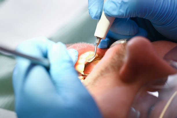 Best Dental Abscess Treatment in French Lick, IN